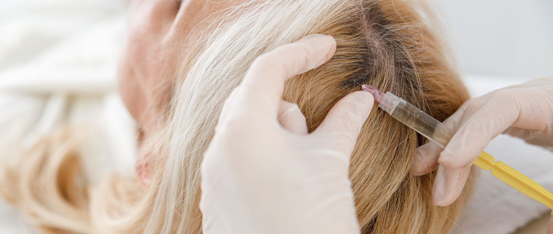 PRP e lipofilling per migliorare l'aspetto del viso e dei capelli